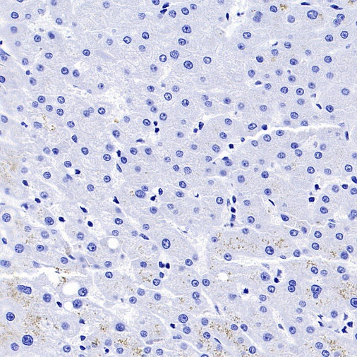 AQP4 Recombinant Rabbit mAb (S-1609-62)