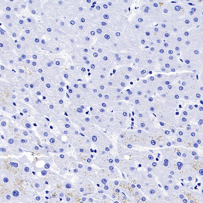 AQP4 Recombinant Rabbit mAb (S-1609-62)