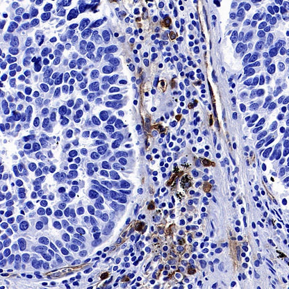CD123 Recombinant Rabbit mAb (S-1592-12)