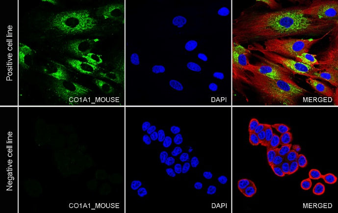 COL1A1 Recombinant Rabbit mAb (S-2975-9)