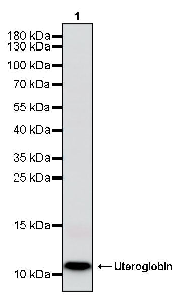 Uteroglobin Recombinant Rabbit mAb (S-6021)