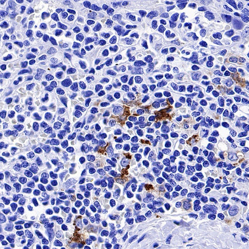CD1a Recombinant Rabbit mAb (S-1486-65)