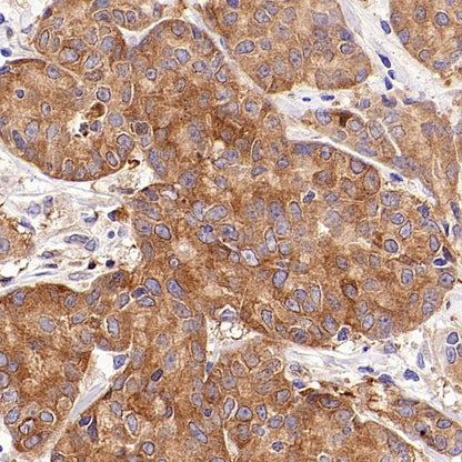 GPHN Recombinant Rabbit mAb (S-3167-63)