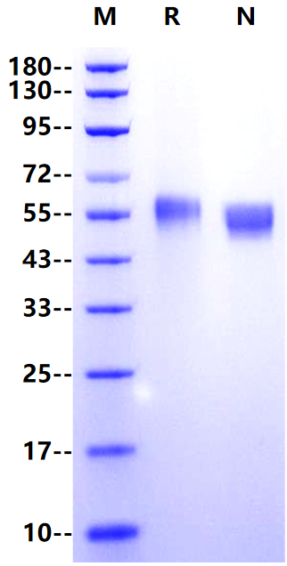 IL-18Rβ/IL-1R7 His Tag Protein, Human