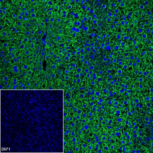 Coagulation factor V Recombinant Rabbit mAb (S-4489-58)