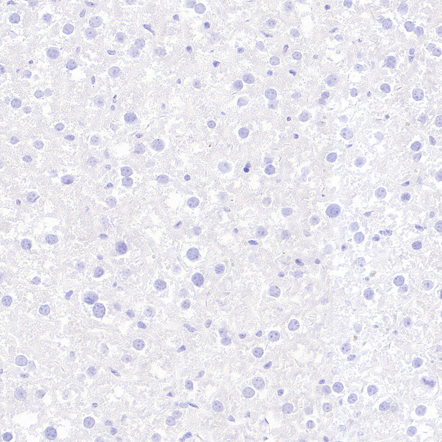 BRN3A Recombinant Rabbit mAb (S-3253-25)