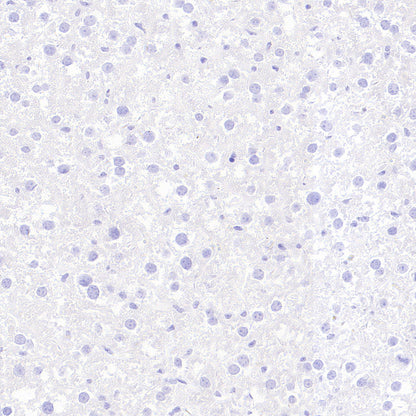 BRN3A Recombinant Rabbit mAb (S-3253-25)