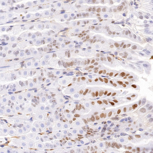 c-Fos Recombinant Rabbit mAb (S-1391-63)