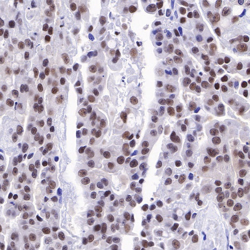 PMS2 Recombinant Rabbit mAb (SDT-111-307)