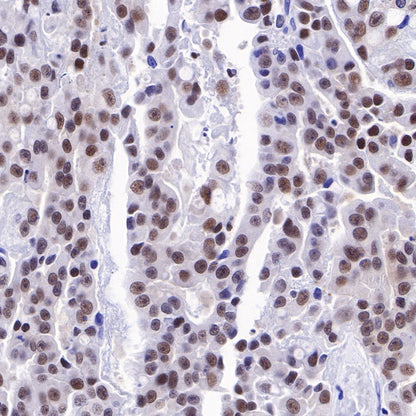 PMS2 Recombinant Rabbit mAb (SDT-111-307)