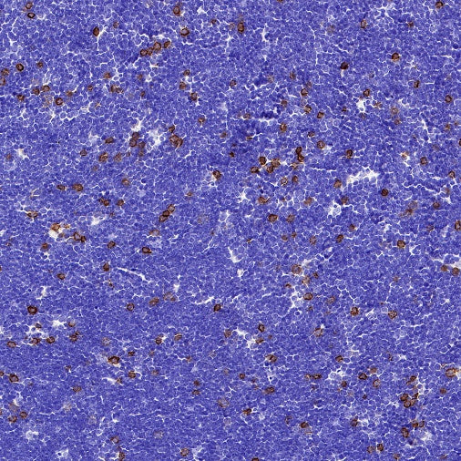 CD25/IL-2Rα Recombinant Rabbit mAb (SDT-2234-65)