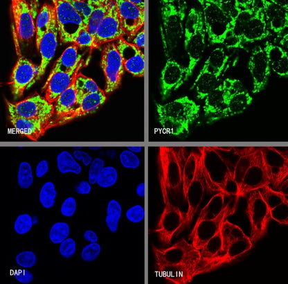 PYCR1 Rabbit Polyclonal Antibody