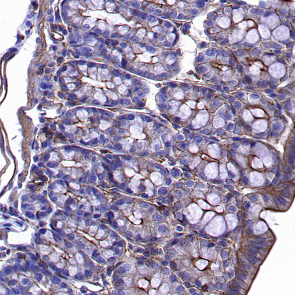 β-Actin Recombinant Rabbit mAb (S-5701)