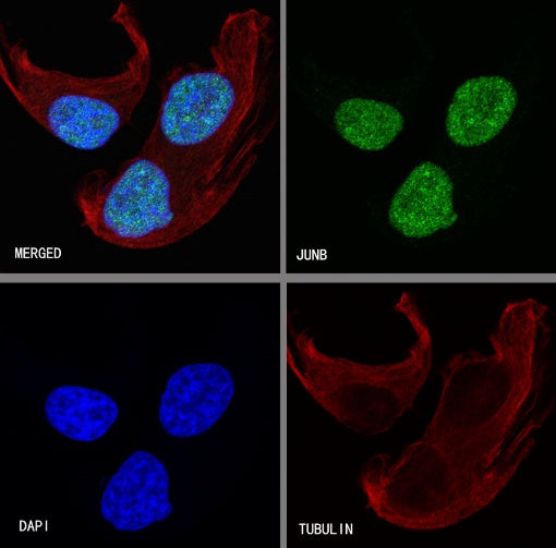 JunB Recombinant Rabbit mAb (S-R294)