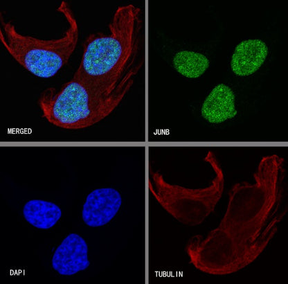 JunB Recombinant Rabbit mAb (S-R294)
