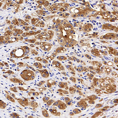Rab3D Recombinant Rabbit mAb (S-4406-22)