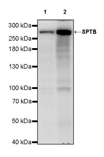 SPTB Recombinant Rabbit mAb (S-755-63)