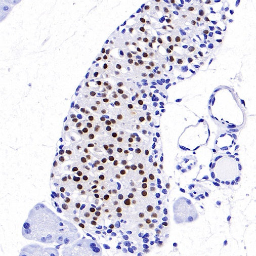 NKX6.1 Recombinant Rabbit mAb (SDT-260-79)