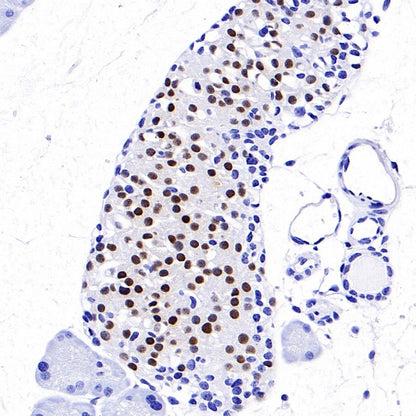 NKX6.1 Recombinant Rabbit mAb (SDT-260-79)