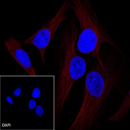 β-tubulin Recombinant Rabbit mAb (Alexa Fluor®555 Conjugate) (S-312-113)