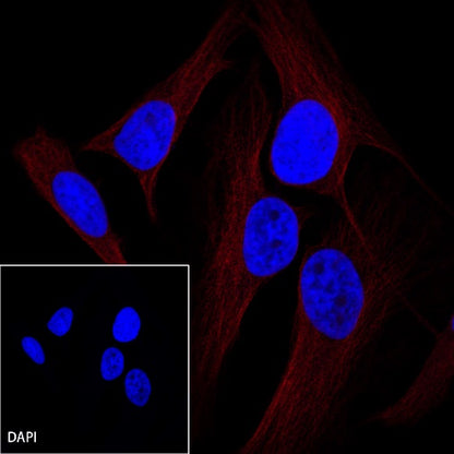 β-tubulin Recombinant Rabbit mAb (Alexa Fluor®555 Conjugate) (S-312-113)