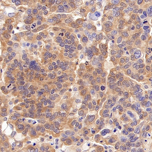 eIF5A Rabbit Polyclonal Antibody