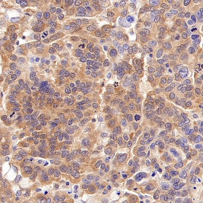 eIF5A Rabbit Polyclonal Antibody