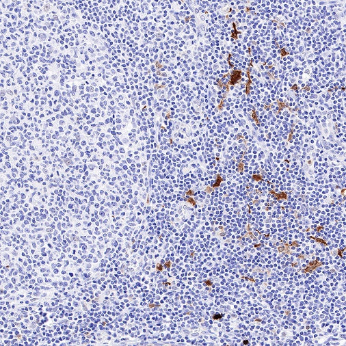 ALOX15 Recombinant Rabbit mAb (S-669-56)