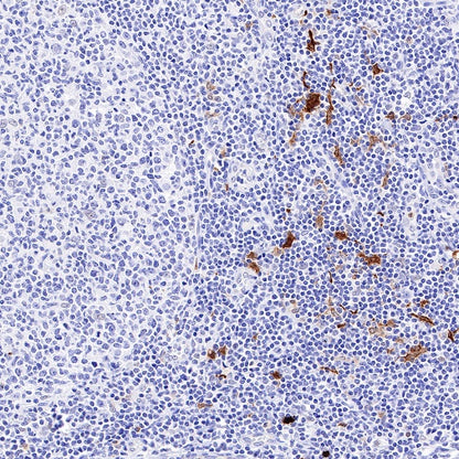 ALOX15 Recombinant Rabbit mAb (S-669-56)