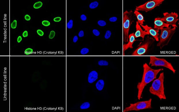 Histone H3 (Crotonyl K9) Recombinant Rabbit mAb (S-R409)