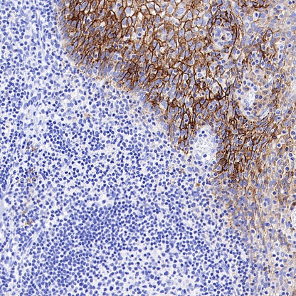 CD44v6 Recombinant Rabbit mAb (S-944-13)