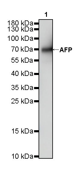 AFP Recombinant Rabbit mAb (SDT-R031)