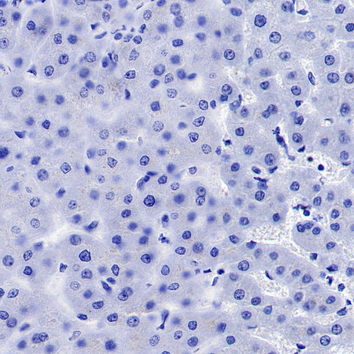 PEG10 Recombinant Rabbit mAb (SDT-442-60)