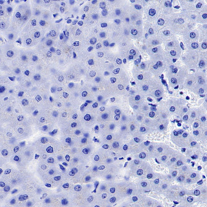 PEG10 Recombinant Rabbit mAb (SDT-442-60)