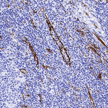 CD31 Recombinant Rabbit mAb (S-R568)