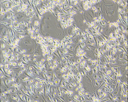 Human Monocyte-Induced Osteoclast Differentiation Cytokine Kit