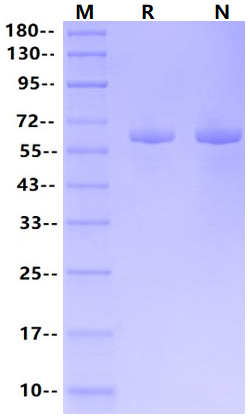 USP14 His Tag Protein, Human