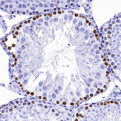 Phospho-Histone H2A.X (Ser139) Recombinant Rabbit mAb (S-1368-15)
