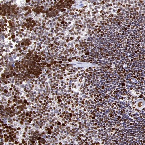 HAT1 Recombinant Rabbit mAb (S-2429-14)