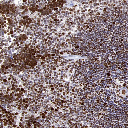 HAT1 Recombinant Rabbit mAb (S-2429-14)