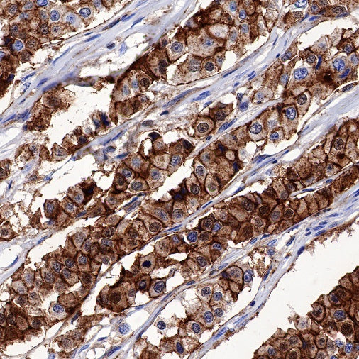 Syntenin Recombinant Rabbit mAb (S-1692-5)
