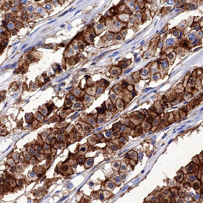 Syntenin Recombinant Rabbit mAb (S-1692-5)