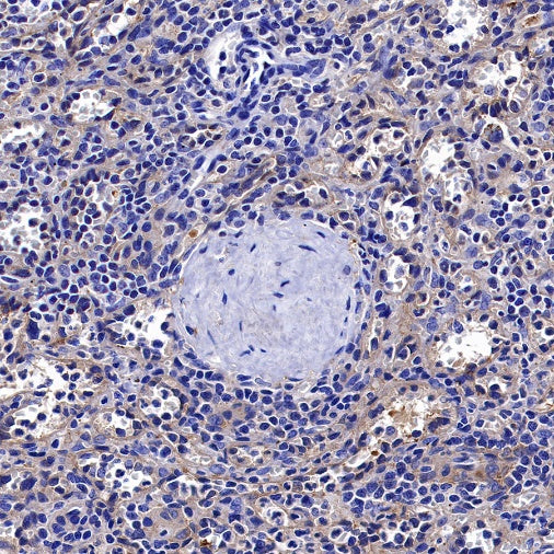 ROCK2 Rabbit Polyclonal Antibody