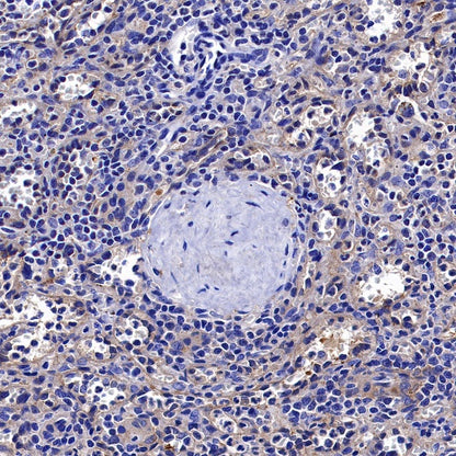 ROCK2 Rabbit Polyclonal Antibody