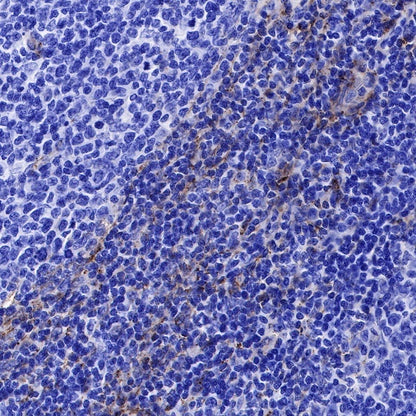 CD90 Recombinant Rabbit mAb (SDT-349-164)