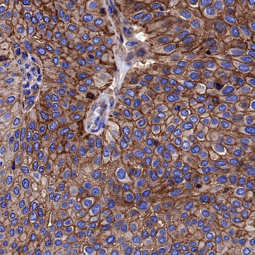 HLA-A Rabbit Polyclonal Antibody