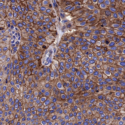 HLA-A Rabbit Polyclonal Antibody