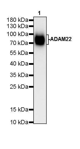ADAM22 Recombinant Rabbit mAb (S-3201-8)
