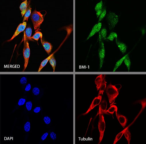 BMI-1 Recombinant Rabbit mAb (S-1075-252)