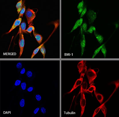 BMI-1 Recombinant Rabbit mAb (S-1075-252)